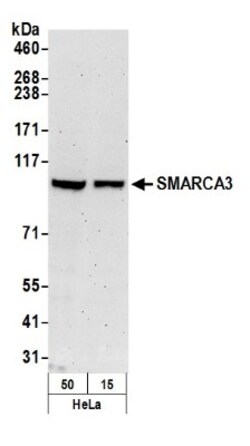 HLTF Antibody, Novus Biologicals 0.1mL; Unlabeled:Antibodies, Polyclonal